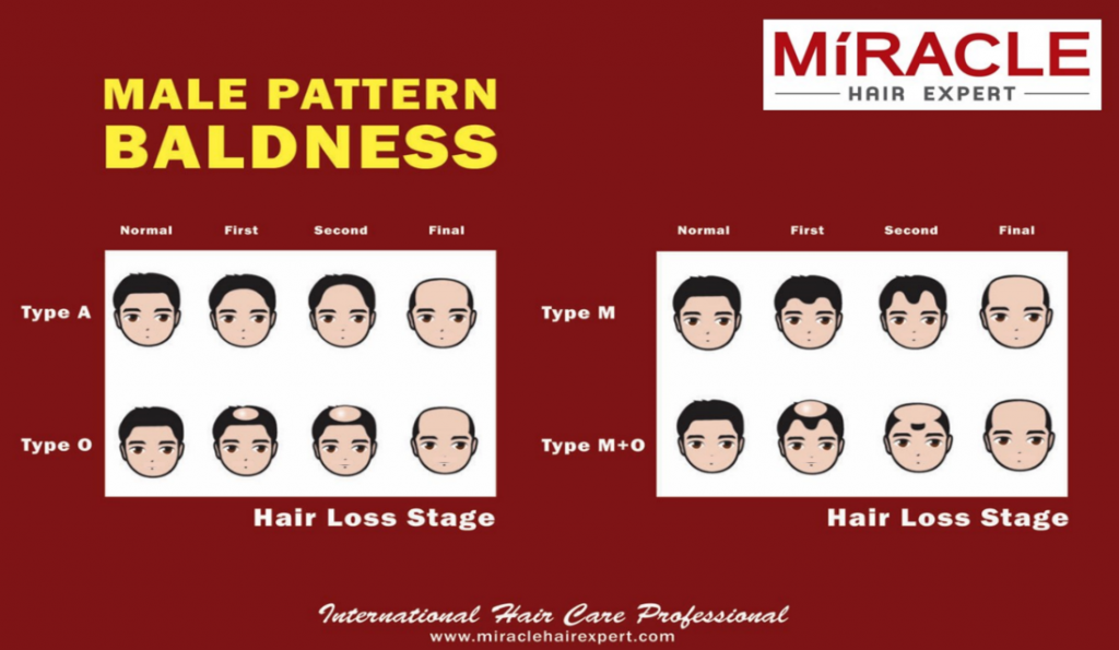 Hair Loss Miracle Hair Expert